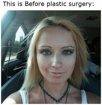 real-life-barbie-before-plastic-surgery3.jpg